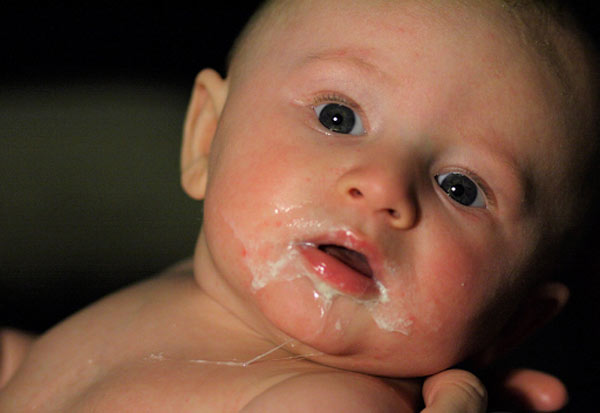 Rơ lưỡi quá sâu hoặc quá mạnh dễ làm trẻ bị nôn trớ sữa.